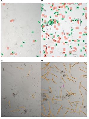 Counting nematodes made easy: leveraging AI-powered automation for enhanced efficiency and precision